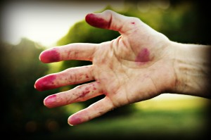 My hand after a morning of picking black raspberries!